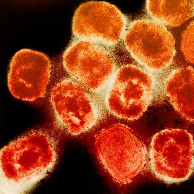 Partícula do vírus da Mpox. Imagem: Wikimedia Commons